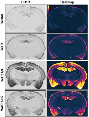 Cannabinoids in Audiogenic Seizures: From Neuronal Networks to Future Perspectives for Epilepsy Treatment